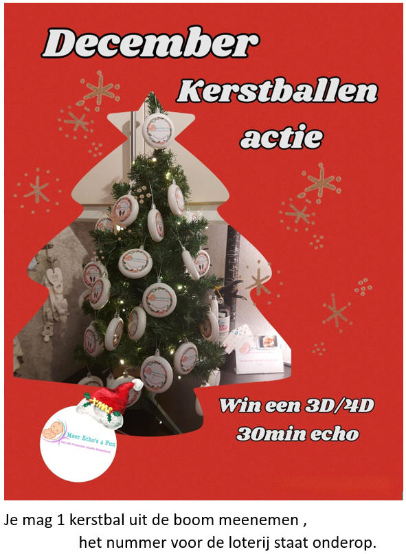 kerstballen actie
